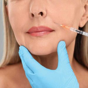 elimina el surco nasogeniano en una sesión