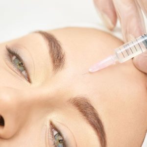 tratamiento botox en la frente antes y después en la Clinica de Medicina Estetica DA de Madrid