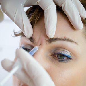 botox entrecejo en Madrid, tratamiento en la clinica de medicina estetica DA