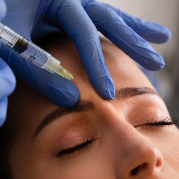 ventajas del botox para el entrecejo en la clinica de medicina estetica de Madrid DA ventajas del botox para el entrecejo en la clinica de medicina estetica de Madrid DA