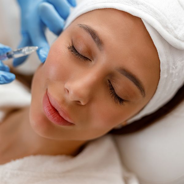 aumento de pómulos o relleno de pómulos con acido hialuronico en la Clinica de Medicina Estetica de Madrid DA