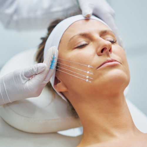 Hilos Tensores en la clínica de medicina estética DA en Madrid