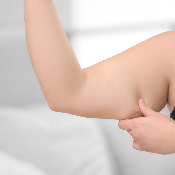 intralipoterapia brazos