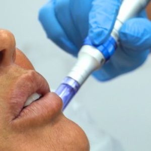 Dermapen Madrid con Marta Lopez tratamiento médico estético de la Clínica de Medicina Estetica DA