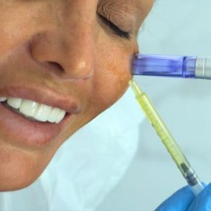 Dermapen Facial con Marta Sanchez en Clinica DA