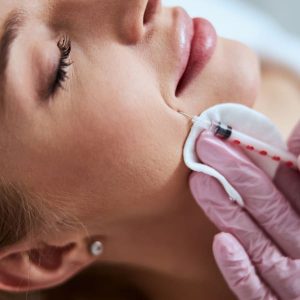 sculptra disminucion surco nasogeniano sculptra disminucion surco nasogeniano