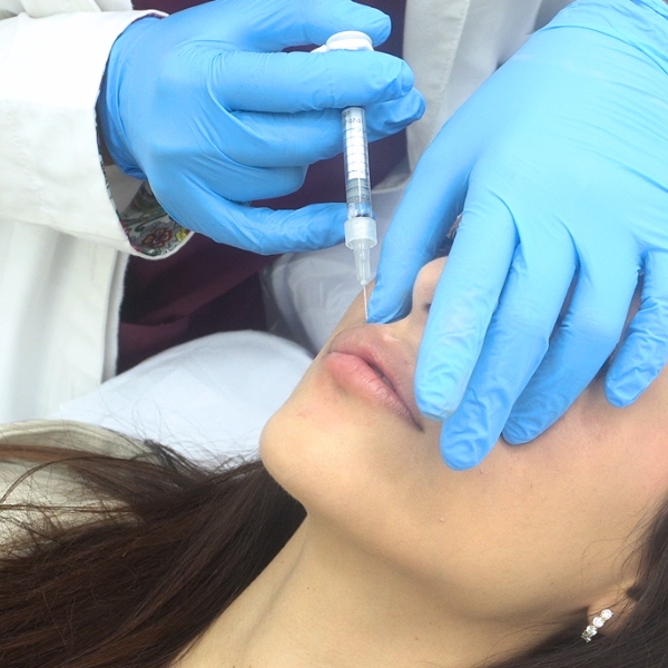 aumenta o hidrata los labios en la clinica de medicina estetica Madrid. Paciente de DA