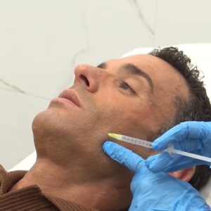 Enzimas Faciales con Antonio Rossi en Clinica DA Enzimas Faciales con Antonio Rossi en Clinica DA