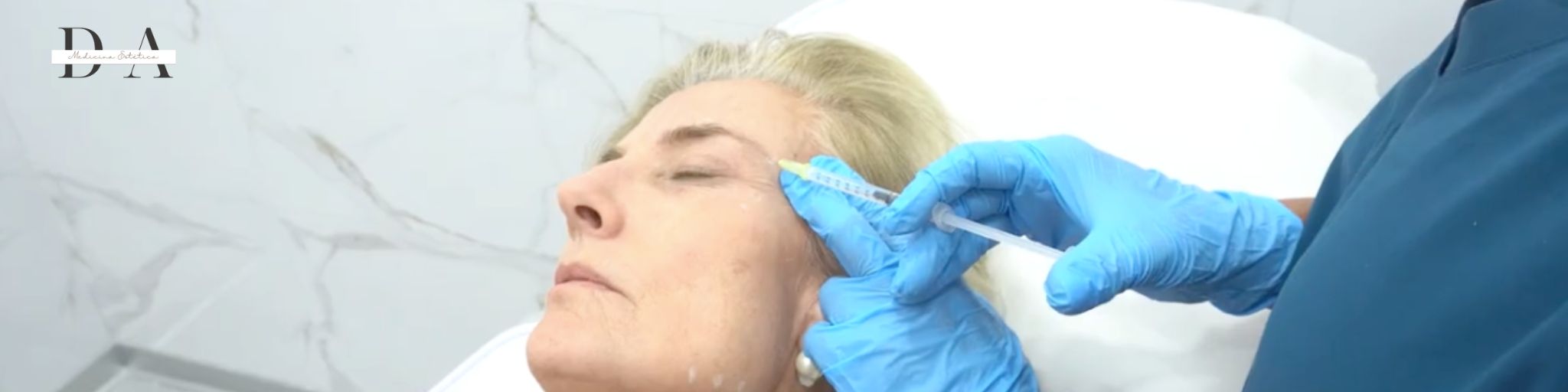 Mejor clinica botox al mejor precio Madrid