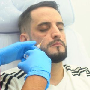 Mejor clínica relleno ojeras Madrid en la Clínica de Medicina Estética DA