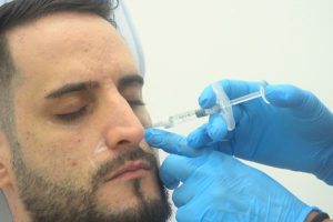 Mejor clínica eliminar ojeras Madrid en la Clínica de Medicina Estética DA